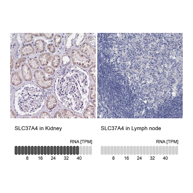 Atlas Antibodies Anti-SLC37A4 Antibody