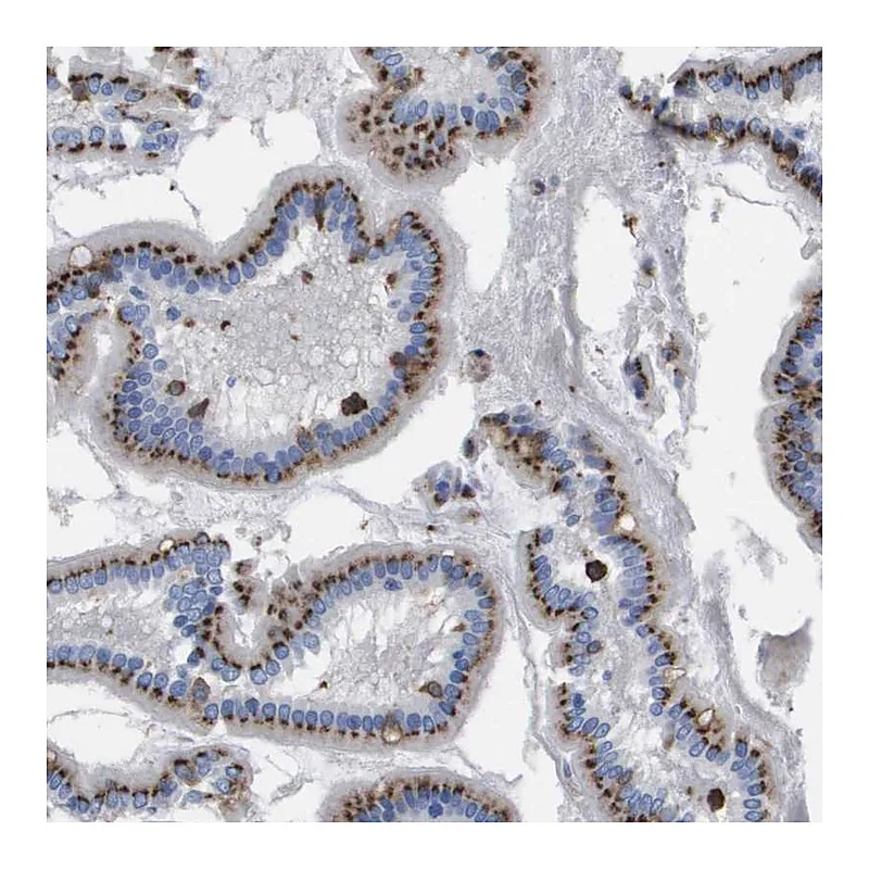 Atlas Antibodies Anti-SLC37A2 Antibody