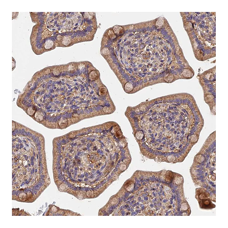 Atlas Antibodies Anti-SLC38A11 Antibody