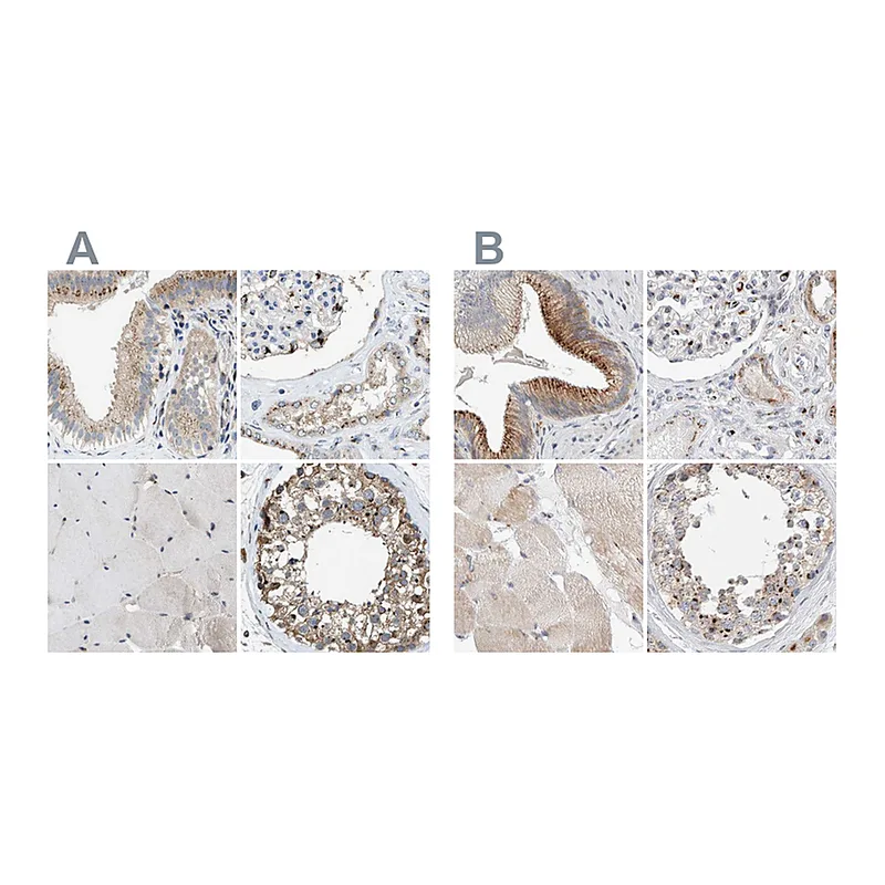 Atlas Antibodies Anti-SLC38A10 Antibody