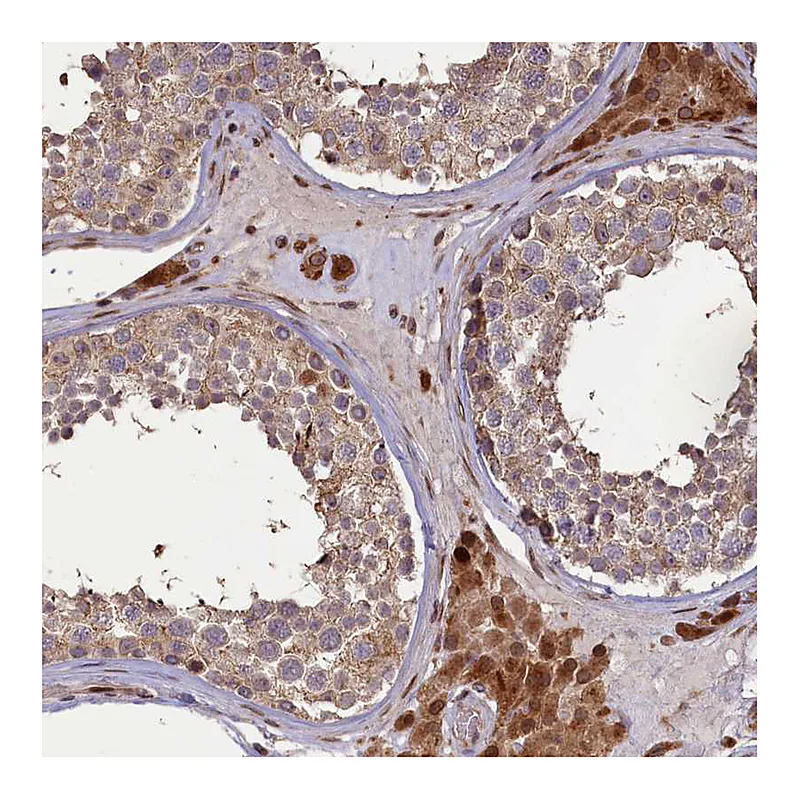 Atlas Antibodies Anti-SLC38A7 Antibody