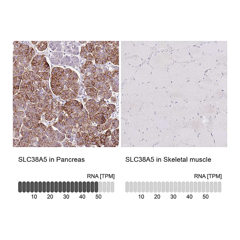 Atlas Antibodies Anti-SLC38A5 Antibody
