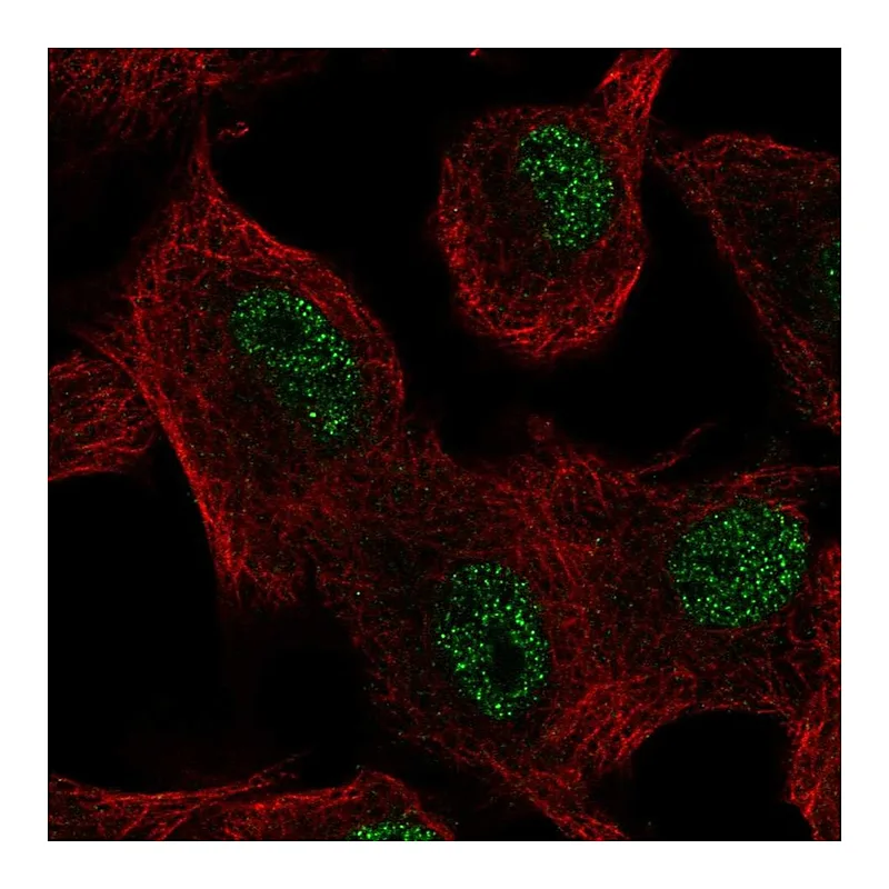 Atlas Antibodies Anti-SLC39A11 Antibody