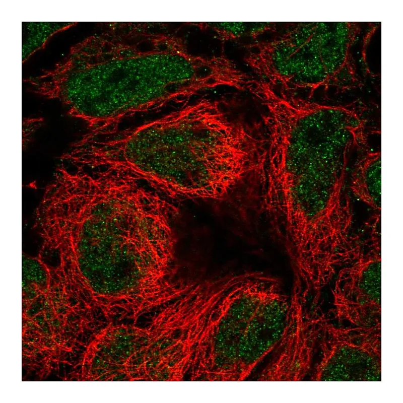 Atlas Antibodies Anti-SLC39A10 Antibody