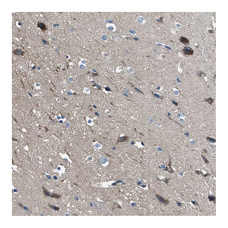 Atlas Antibodies Anti-SLC38A6 Antibody