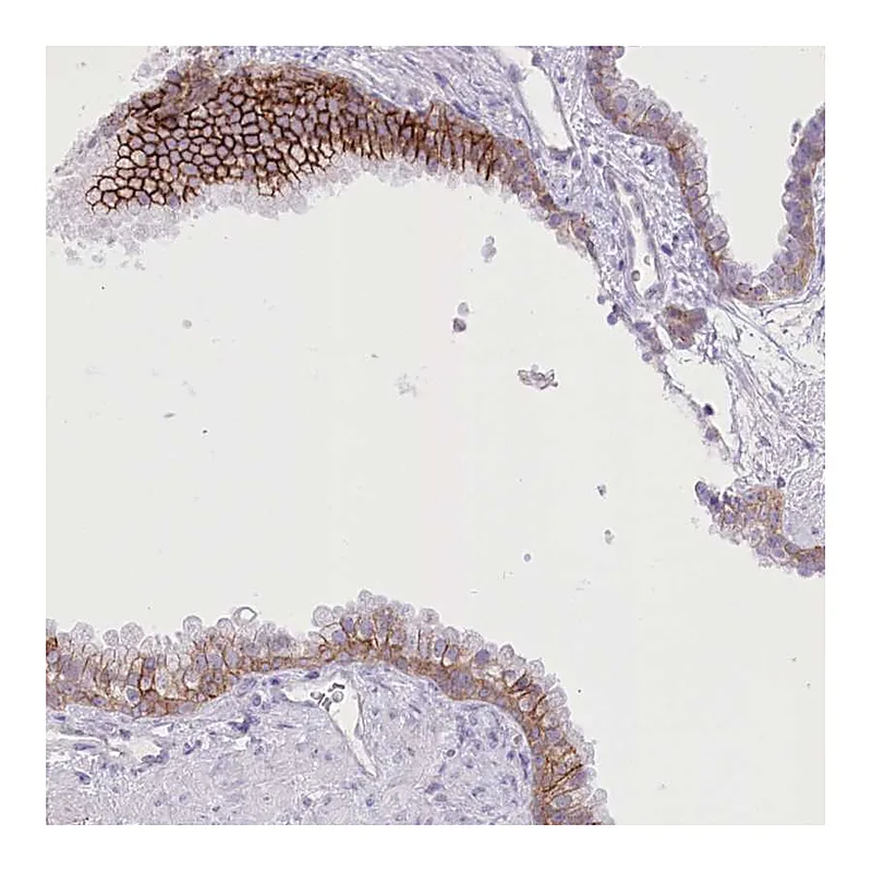 Atlas Antibodies Anti-SLC39A10 Antibody