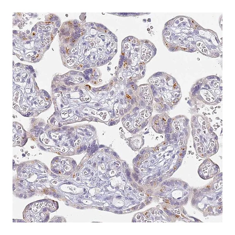 Atlas Antibodies Anti-SLC38A9 Antibody