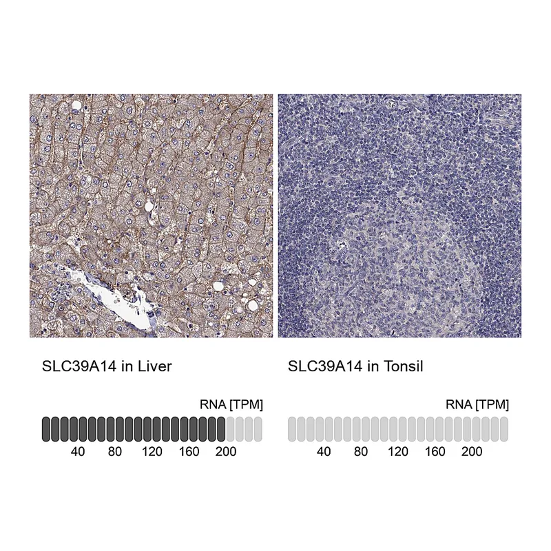 Atlas Antibodies Anti-SLC39A14 Antibody