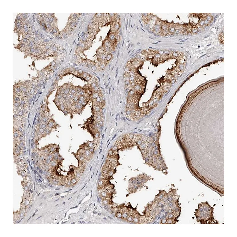 Atlas Antibodies Anti-SLC39A2 Antibody