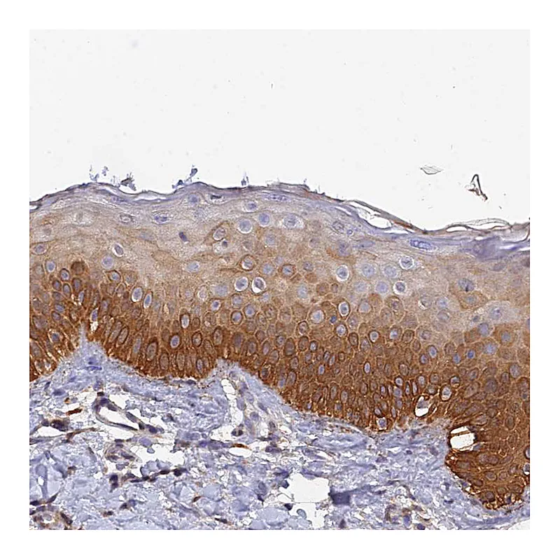 Atlas Antibodies Anti-SLC39A13 Antibody