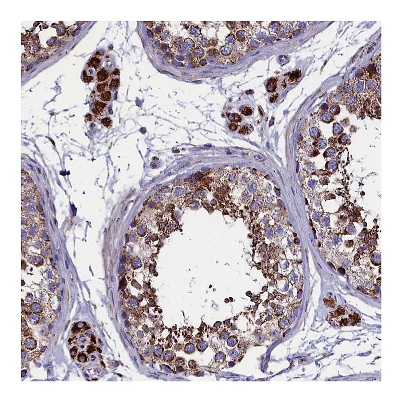 Atlas Antibodies Anti-SLC39A3 Antibody