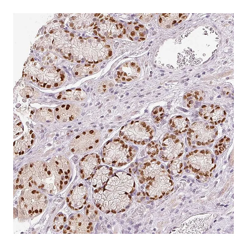 Atlas Antibodies Anti-SLC39A3 Antibody