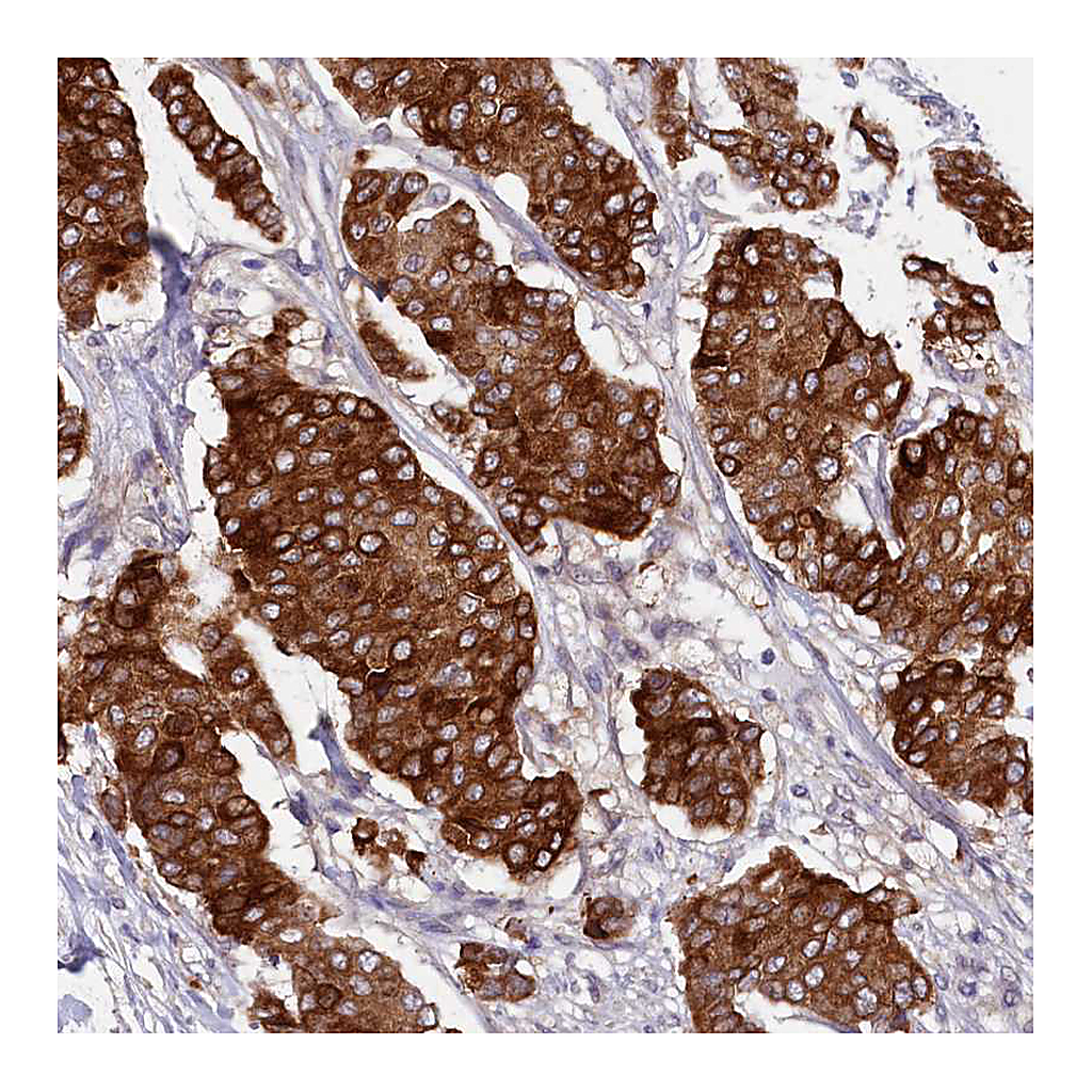Atlas Antibodies Anti-SLC39A6 Antibody