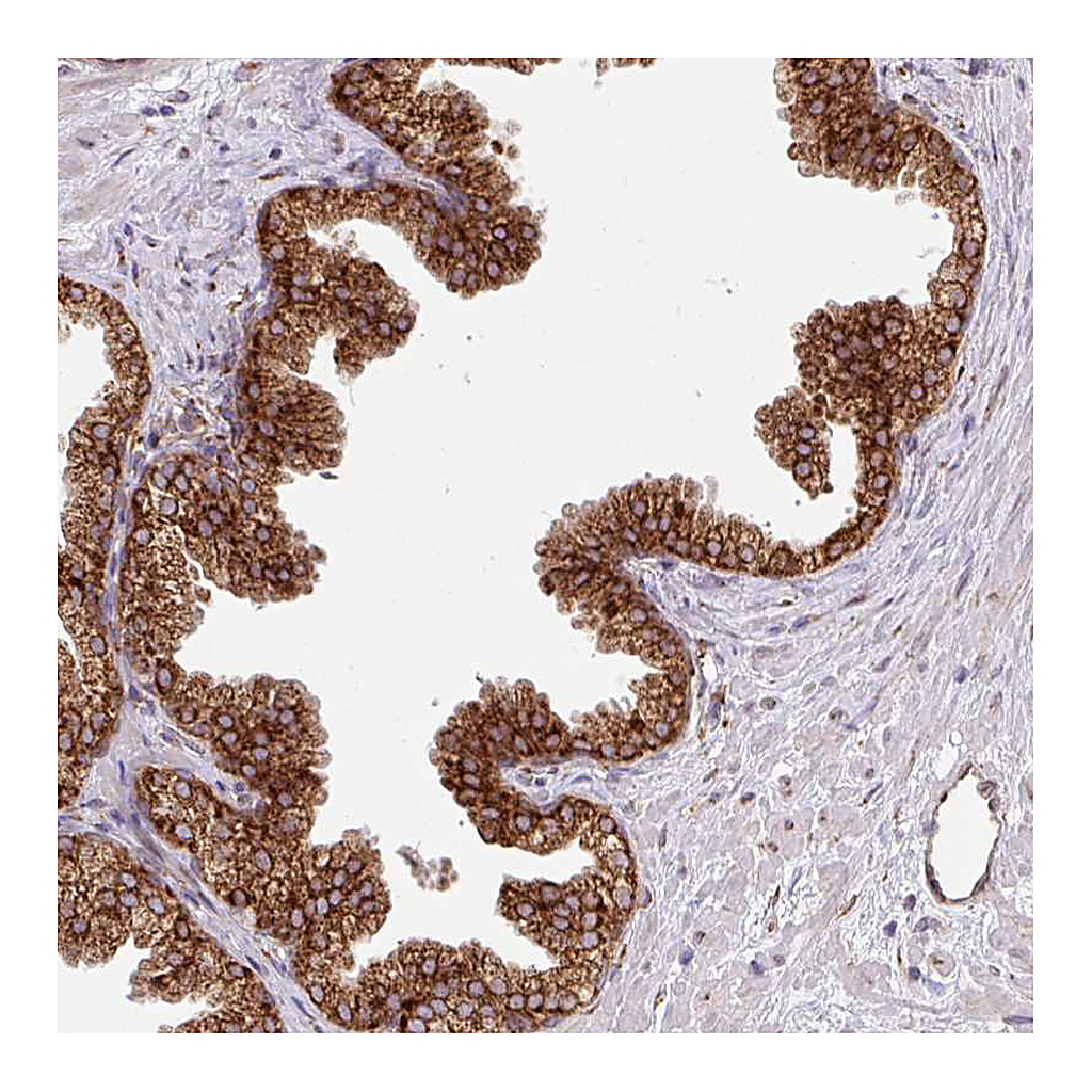 Atlas Antibodies Anti-SLC39A7 Antibody