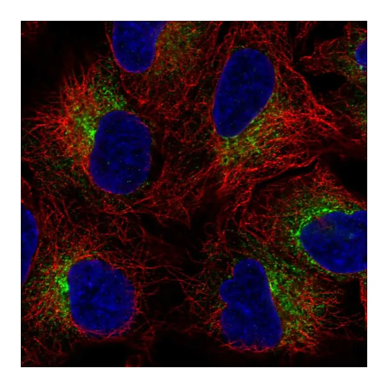 Atlas Antibodies Anti-SLC39A9 Antibody