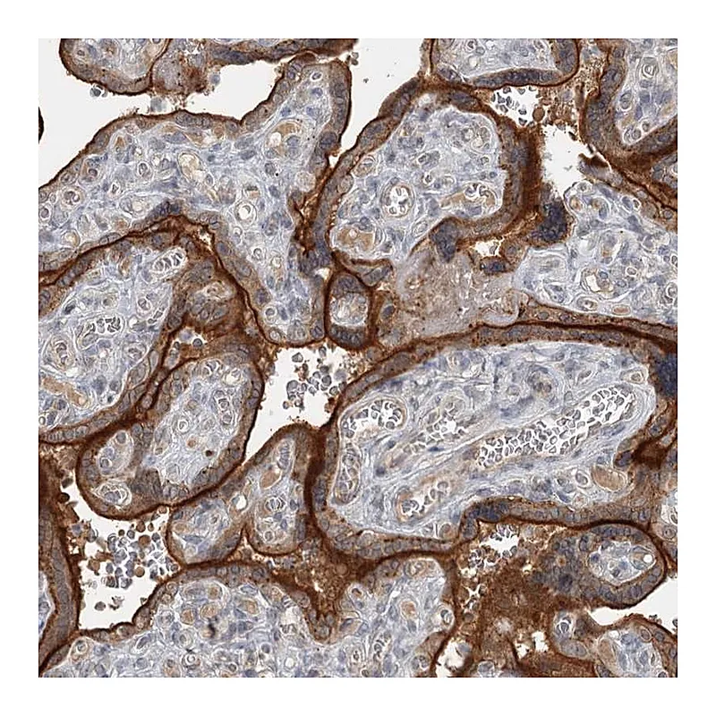 Atlas Antibodies Anti-SLC39A8 Antibody