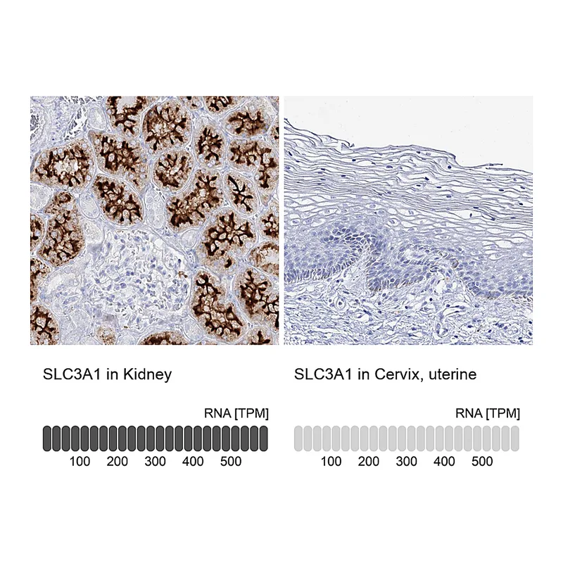 Atlas Antibodies Anti-SLC3A1 Antibody