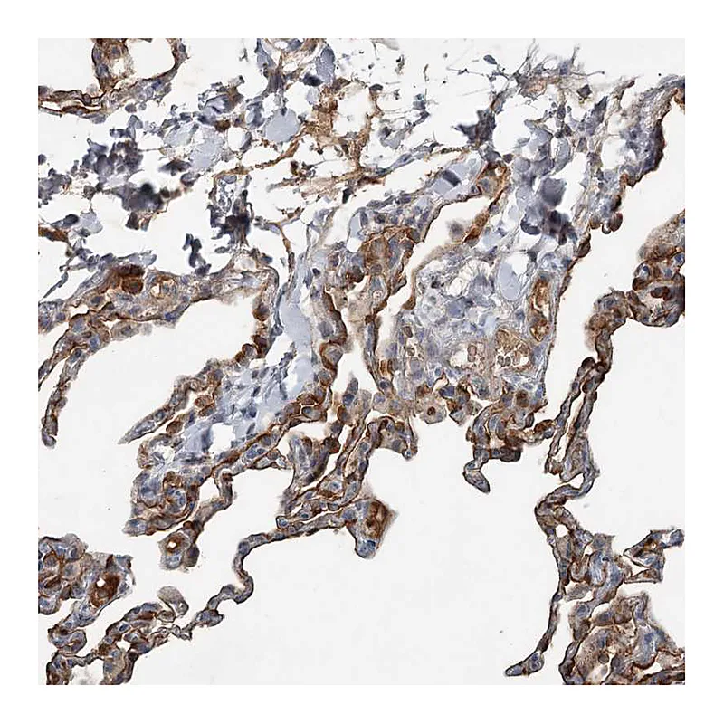 Atlas Antibodies Anti-SLC39A8 Antibody