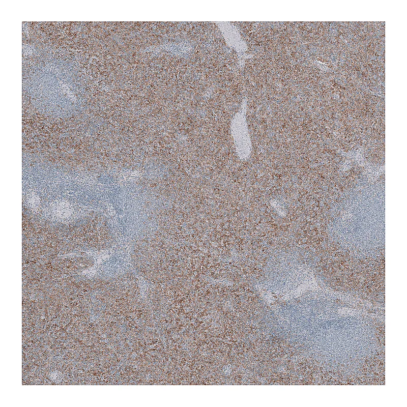 Atlas Antibodies Anti-SLC40A1 Antibody