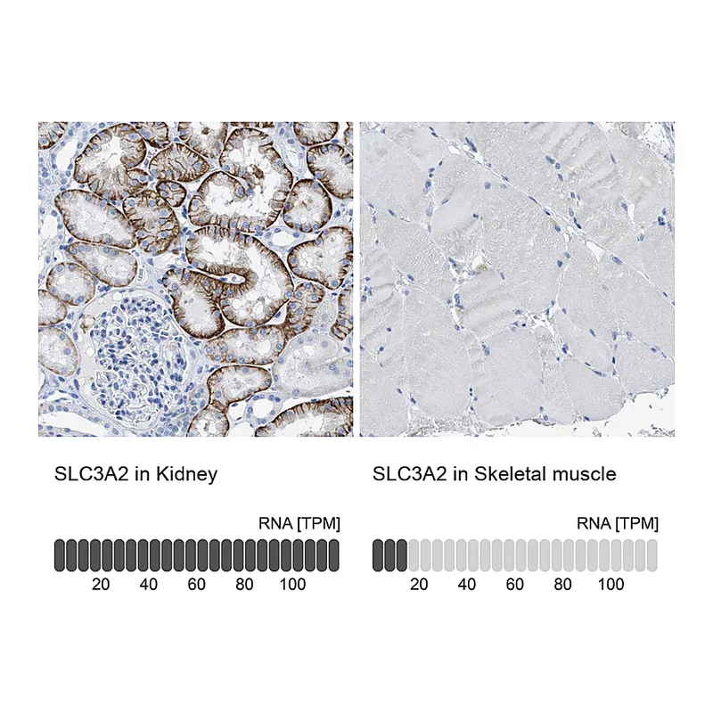 Atlas Antibodies Anti-SLC3A2 Antibody