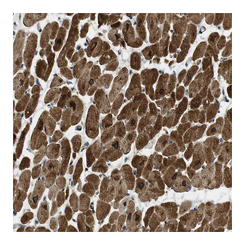 Atlas Antibodies Anti-SLC41A1 Antibody