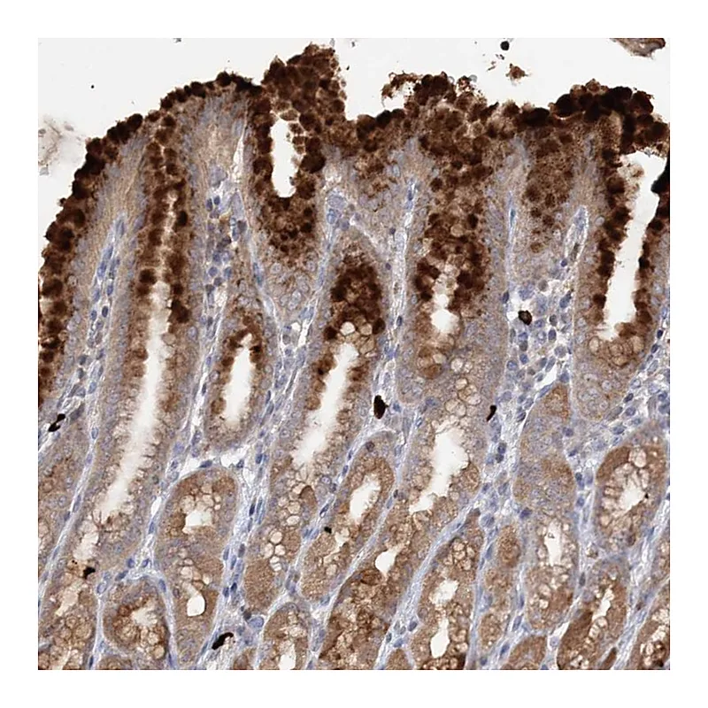 Atlas Antibodies Anti-SLC41A2 Antibody