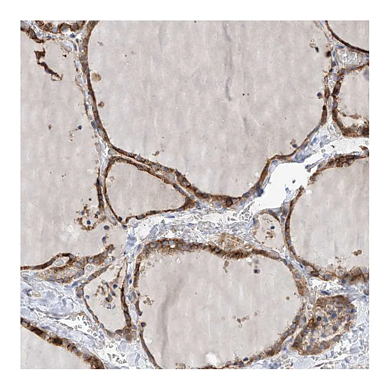 Atlas Antibodies Anti-SLC43A3 Antibody