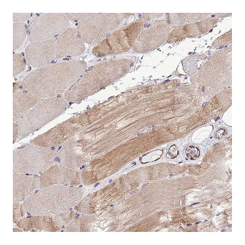 Atlas Antibodies Anti-SLC41A3 Antibody