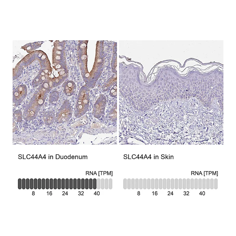 Atlas Antibodies Anti-SLC44A4 Antibody