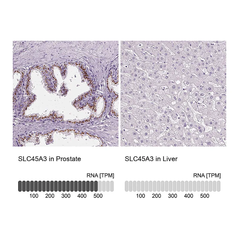 Atlas Antibodies Anti-SLC45A3 Antibody