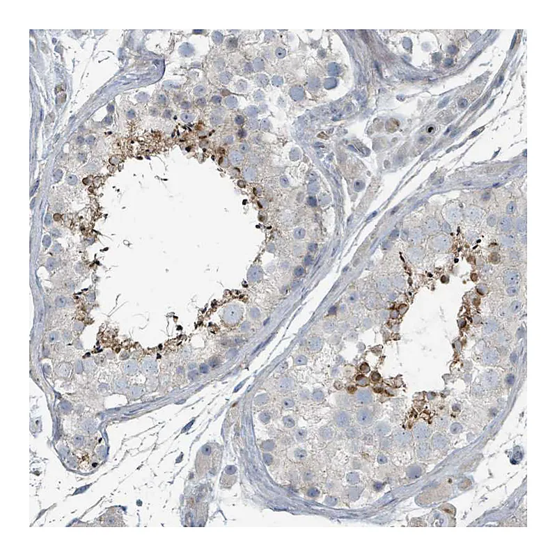Atlas Antibodies Anti-SLC44A5 Antibody
