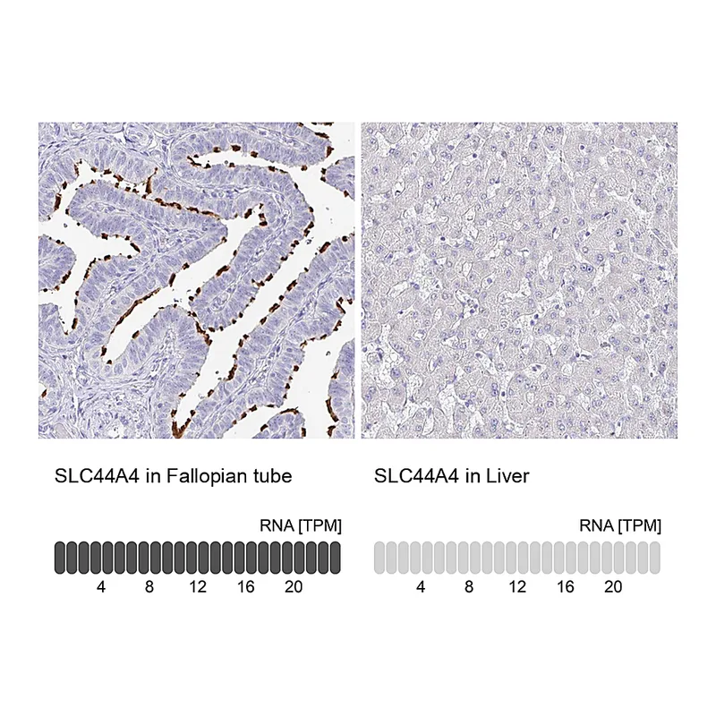 Atlas Antibodies Anti-SLC44A4 Antibody