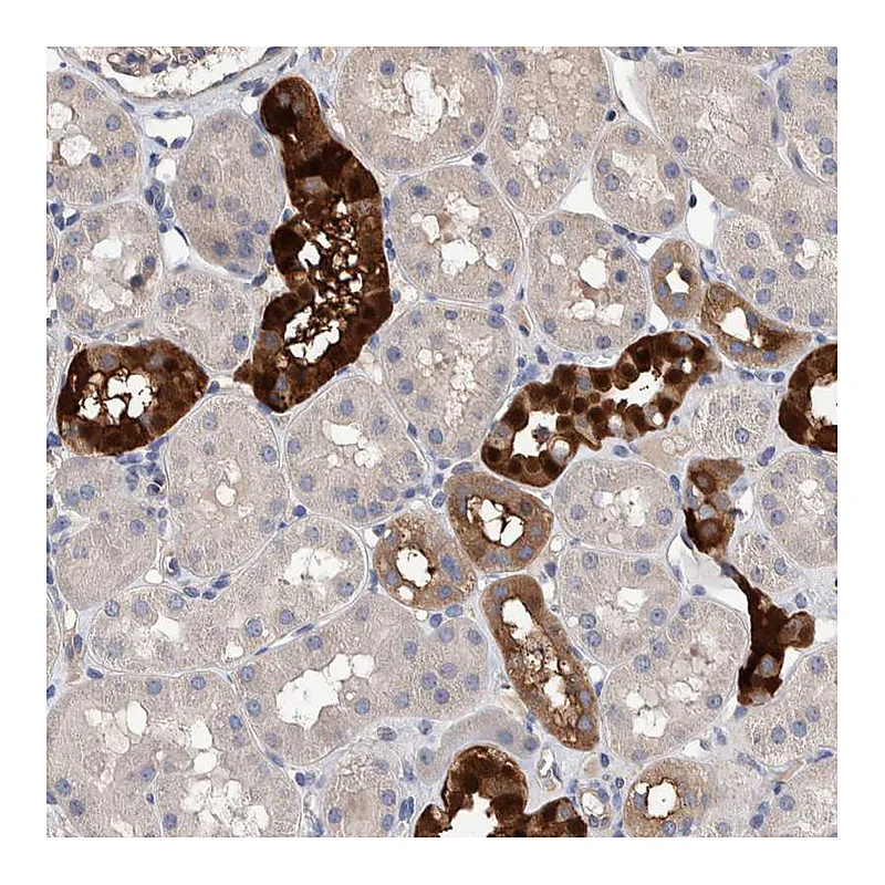 Atlas Antibodies Anti-SLC45A4 Antibody