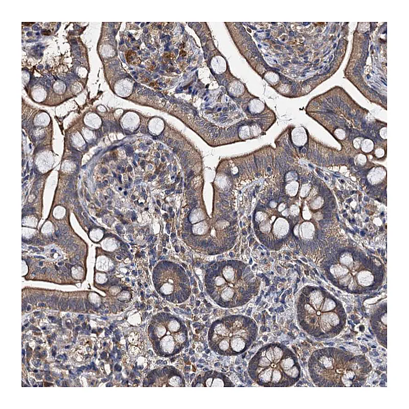 Atlas Antibodies Anti-SLC46A3 Antibody