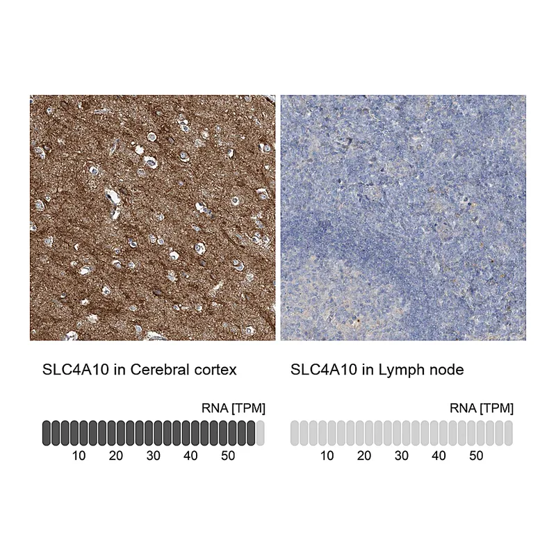 Atlas Antibodies Anti-SLC4A10 Antibody