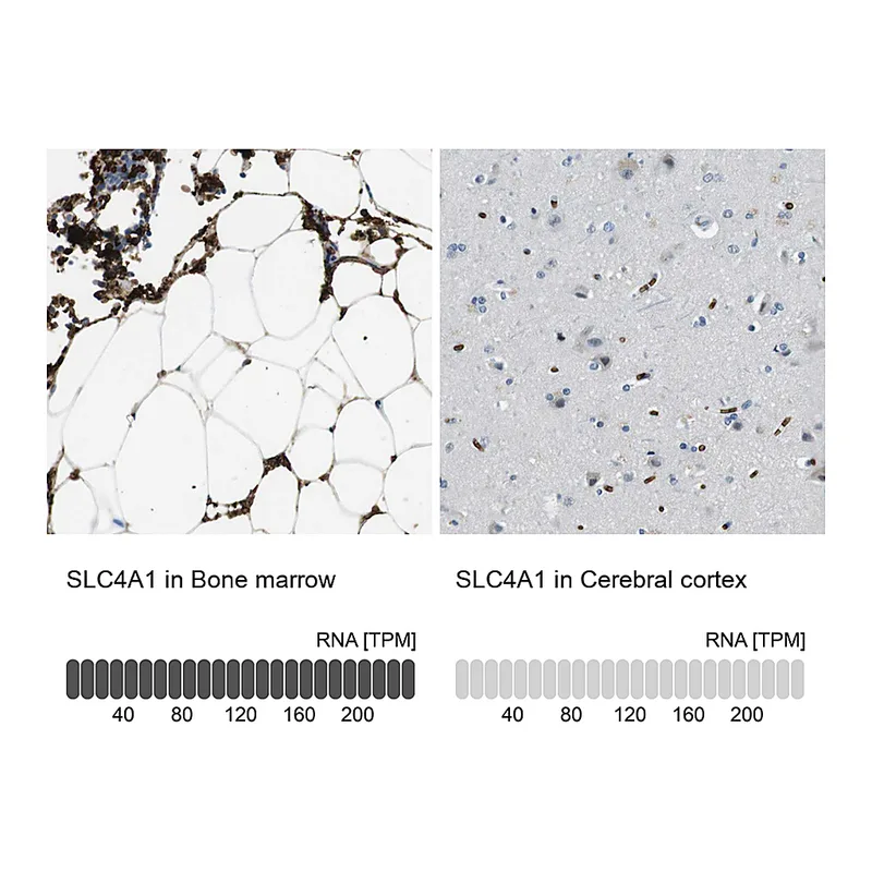 Atlas Antibodies Anti-SLC4A1 Antibody