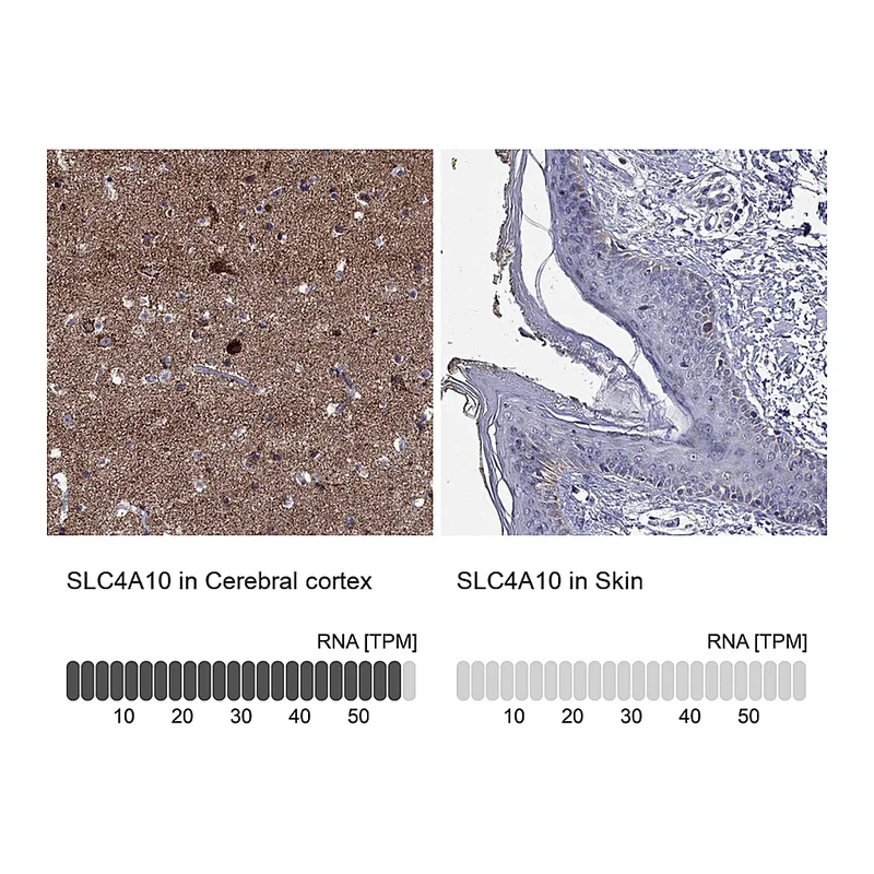 Atlas Antibodies Anti-SLC4A10 Antibody