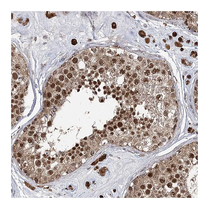 Atlas Antibodies Anti-SLC4A1AP Antibody