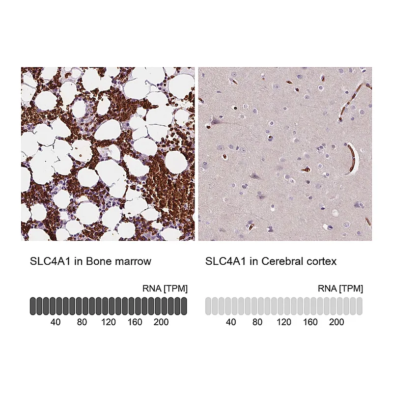 Atlas Antibodies Anti-SLC4A1 Antibody