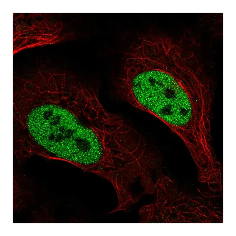 Atlas Antibodies Anti-SLC4A3 Antibody