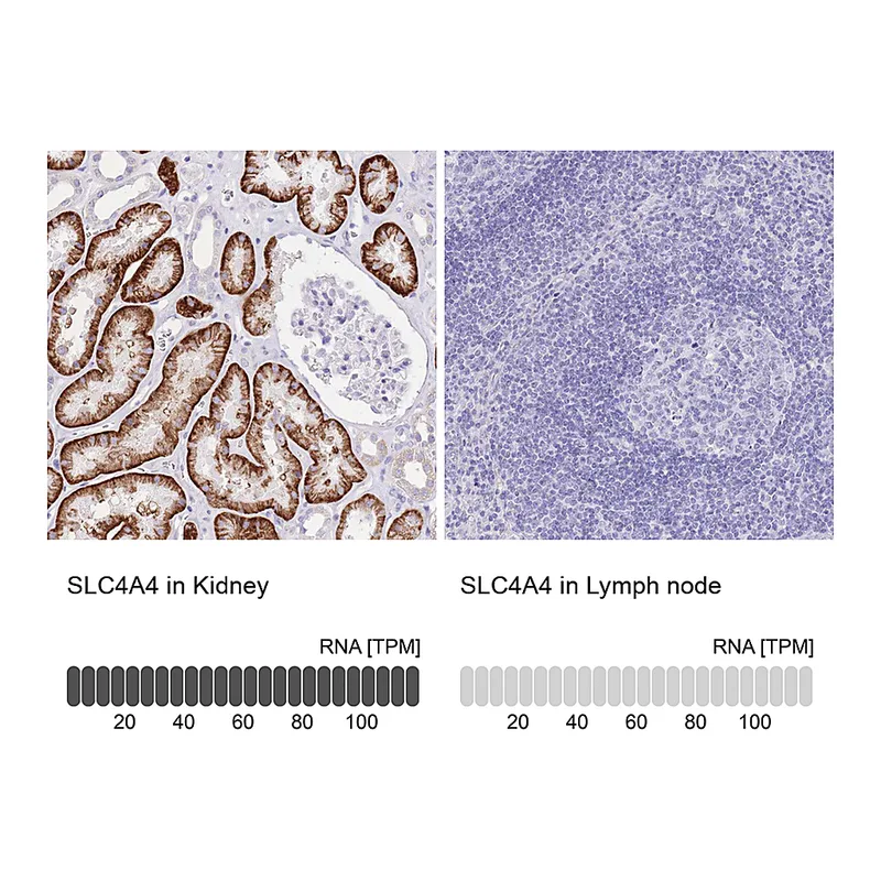 Atlas Antibodies Anti-SLC4A4 Antibody
