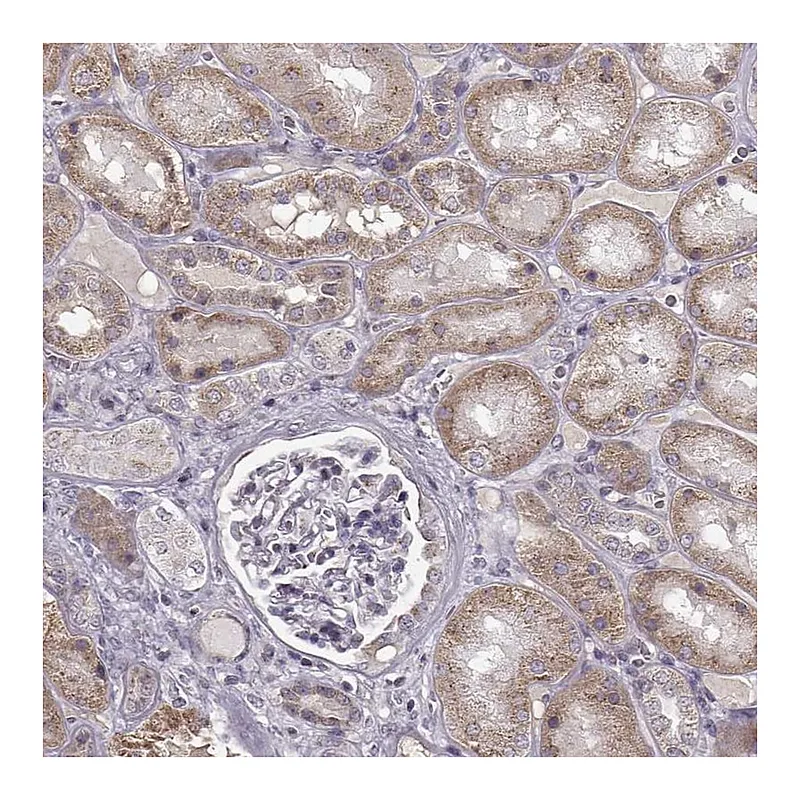 Atlas Antibodies Anti-SLC4A5 Antibody