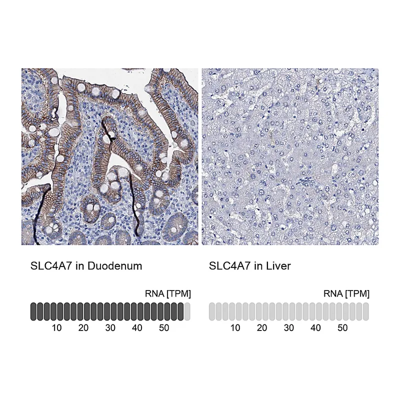 Atlas Antibodies Anti-SLC4A7 Antibody