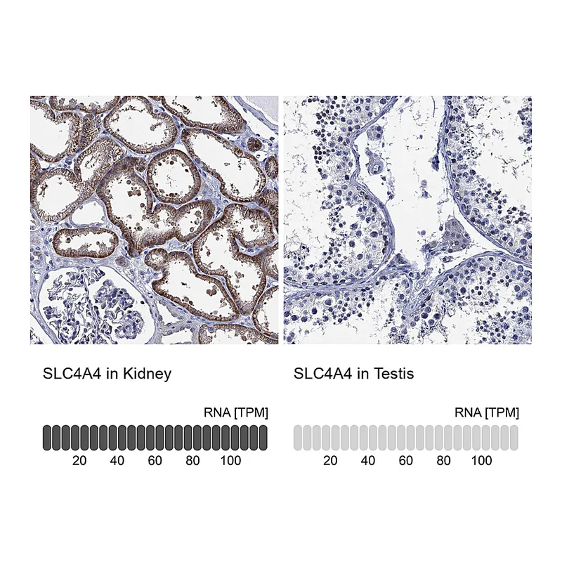 Atlas Antibodies Anti-SLC4A4 Antibody