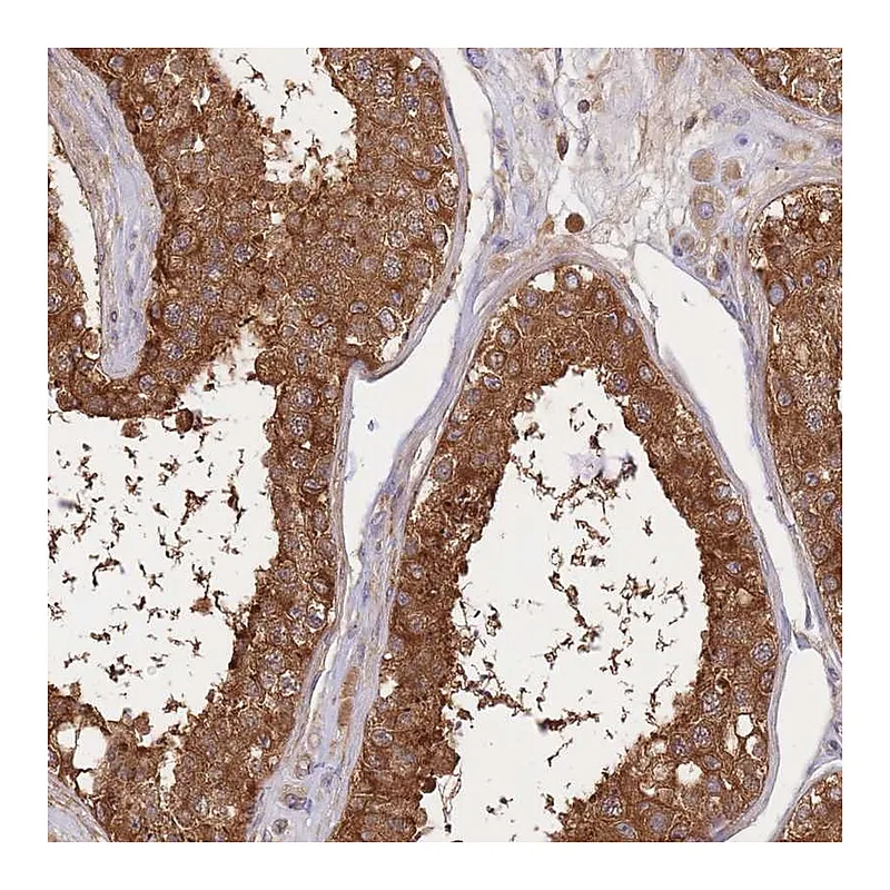 Atlas Antibodies Anti-SLC4A9 Antibody