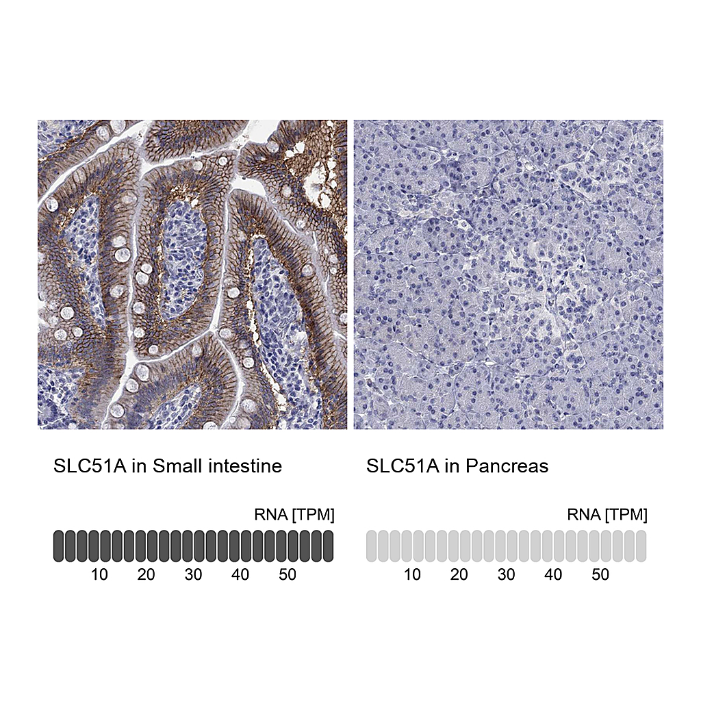 Atlas Antibodies Anti-SLC51A Antibody