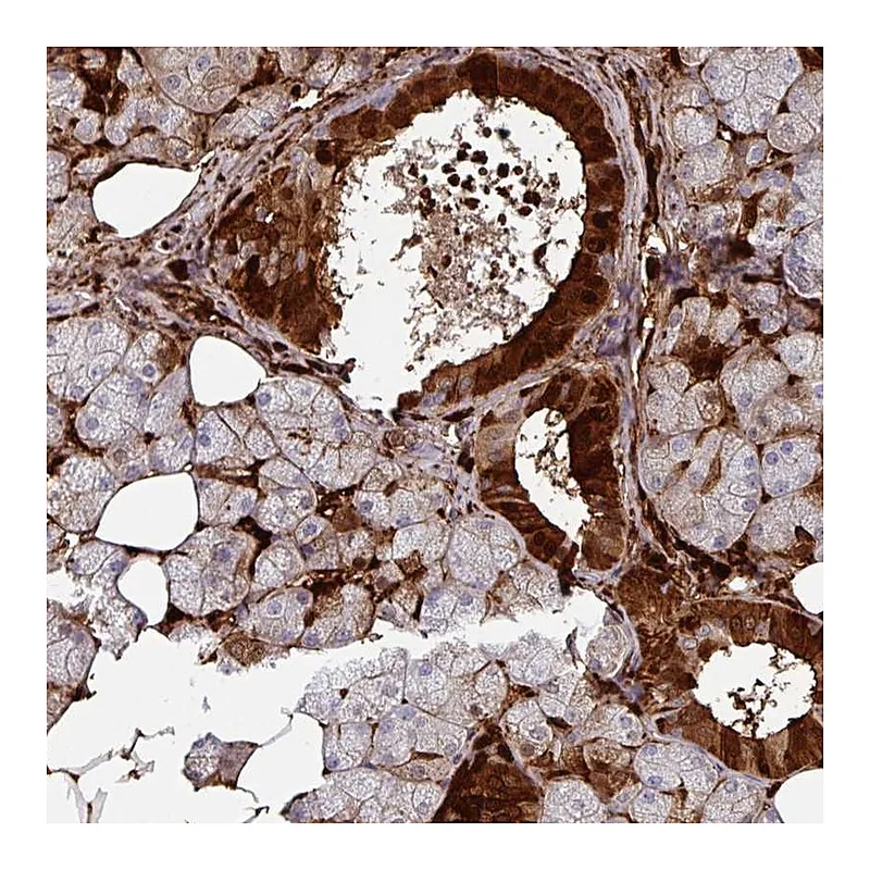 Atlas Antibodies Anti-SLC5A10 Antibody