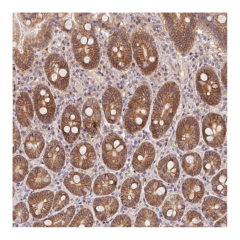 Atlas Antibodies Anti-SLC52A2 Antibody