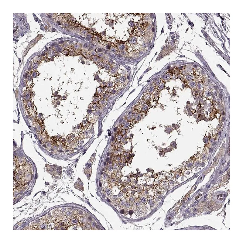 Atlas Antibodies Anti-SLC52A3 Antibody