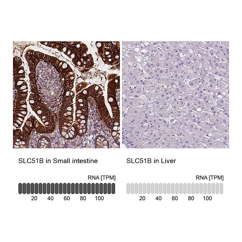 Atlas Antibodies Anti-SLC51B Antibody